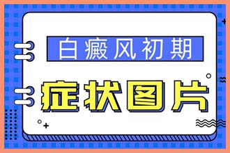 白颠疯病初期照片症状图片脸部几岁长得