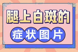 白颠已消除只剩白发还需要照光治疗吗