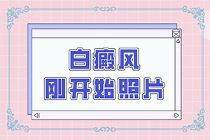 白癫疯为什么一个地方好了别的地方又起呢