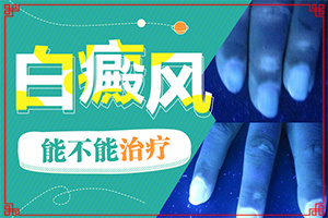 兰州七里河区哪家医院有308激光治疗白癜风