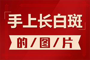 兰州中研白癜风医院离那个车站离得近