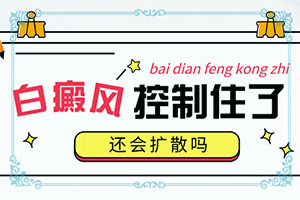 白点癫风是什么科室看的