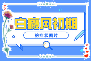 兰州榆中县治疗白癜风的医院哪个比较好