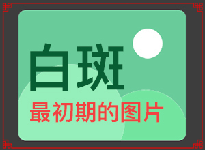 兰州高新区白癜风治的非常好的医院在哪