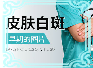 为什么手臂上白了一小块