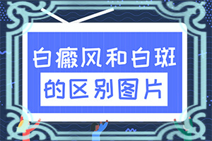 人的皮肤出现了白点什么原因