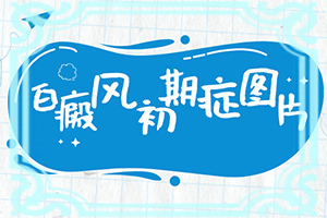小儿脸上有白斑是什么原因,用什么药擦