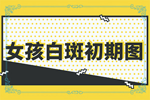 查看白颠症的病有多严重