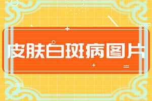 小孩皮肤白色斑块是什么原因引起的
