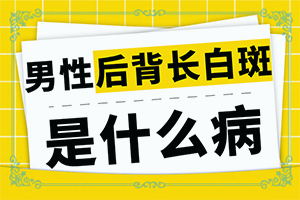 面部节段性白颠怎么治疗
