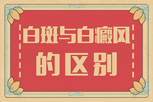 儿童白风癫治疗期间会复发吗