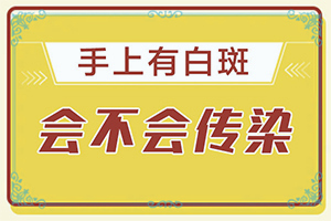 脸上有白块什么原因引起的怎么治疗