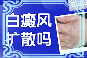 兰州红古区白癜风看的非常好的医院在哪里