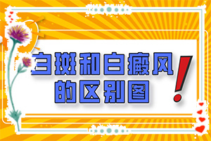 兰州城关区治疗白癜风医院哪个比较正规