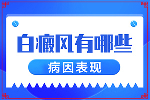 兰州治疗白癜风的医院怎么选择