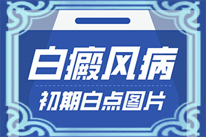 小孩头上长白块是什么原因图片
