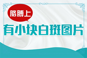 氟轻松软膏可以治白颠吗