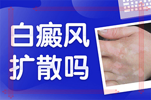 白点癫风早期症状[聚焦皮肤科]白点癫风初期怎么判定