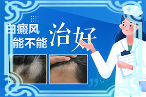 免疫力低下引起儿童身上有白斑可以去掉吗