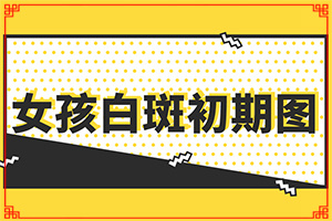 兰州榆中县有哪些专门看白癜风的专科医院