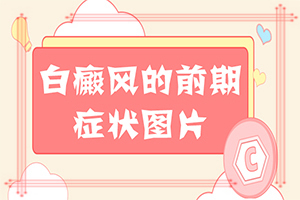 兰州白癜风医院有哪些排行榜准不准