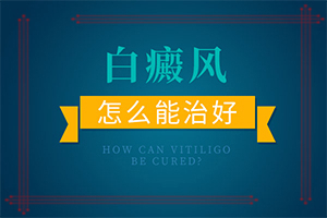 白店风早期症状[做好功课]白癞风初期什么样子