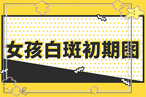 兰州白癜风治疗去哪家医院好更好