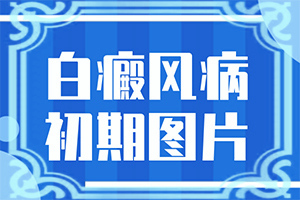 小孩子脸上有一块块的白斑是什么原因