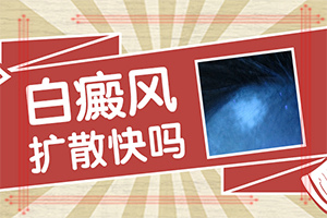 东莞皮肤病去哪里看速度好