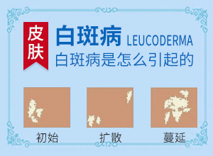 初世期的白颠应如何治疗