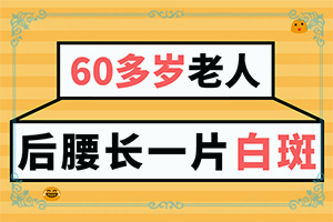 兰州城关区哪个地方可以治疗成人白癜风