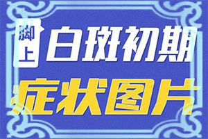 脸上有白斑白斑周围还有鼻血是怎么回事