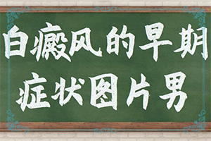皮肤上出现白色斑点是什么原因引起的怎么治疗