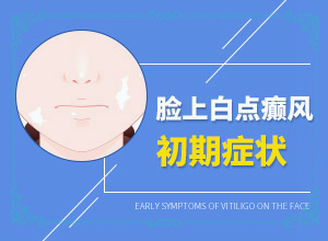 脸上有大片白斑什么原因造成的