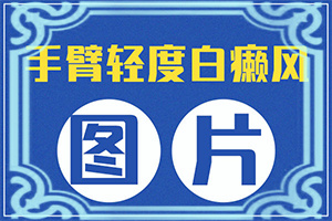 白颠治疗15种偏方2022