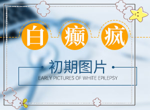 兰州安宁区去哪个治疗白癜风专科医院好
