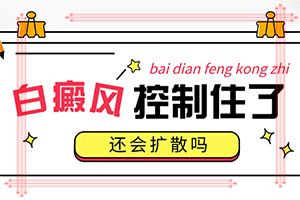 「实力聚焦」白嵿疯是什么引起的-白点癫风缺什么东西