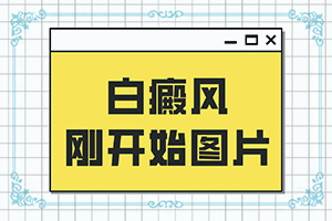 兰州哪家白癜风医院可以治好白癜风