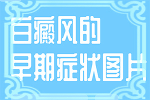 青少年白斑治疗要注意什么问题呢
