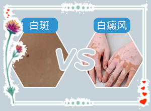 兰州高新区治疗白癜风好的专科医院