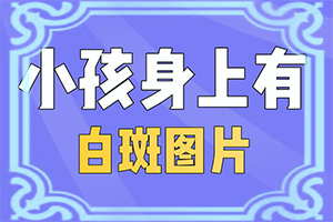 身上皮肤出现白块是什么引起的怎么治疗好