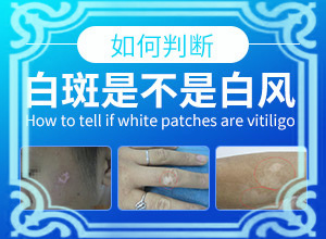 胳膊上有小白点很痒是什么原因图片