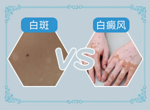 宝宝三岁了腿上有白斑是什么原因