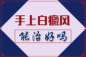 得了白癜风在兰州安宁区哪所医院治疗好