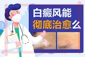白颠疯病症状初期[实力选择]背后长白斑是怎么回事