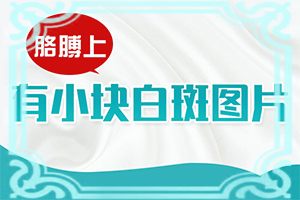 有谁知道孩子脸上长白斑是什么原因