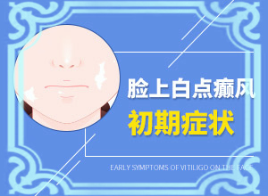 维a酸乳膏治白颠多久见效