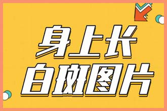 脖子上有白色斑块是什么原因很痒怎么办