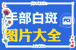 兰州白癜风医院收费高吗