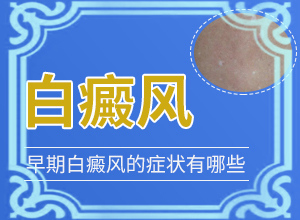 儿童脸上长白斑是什么原因造成的